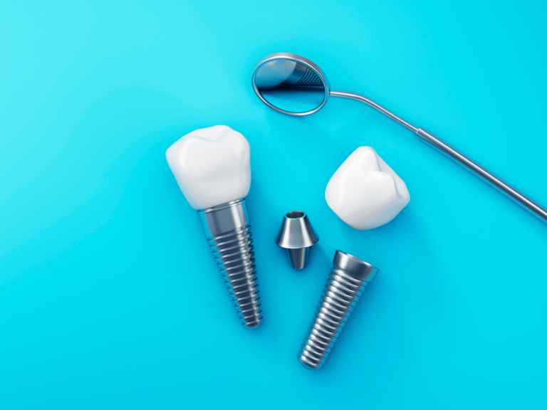 dental implants laying on a blue background