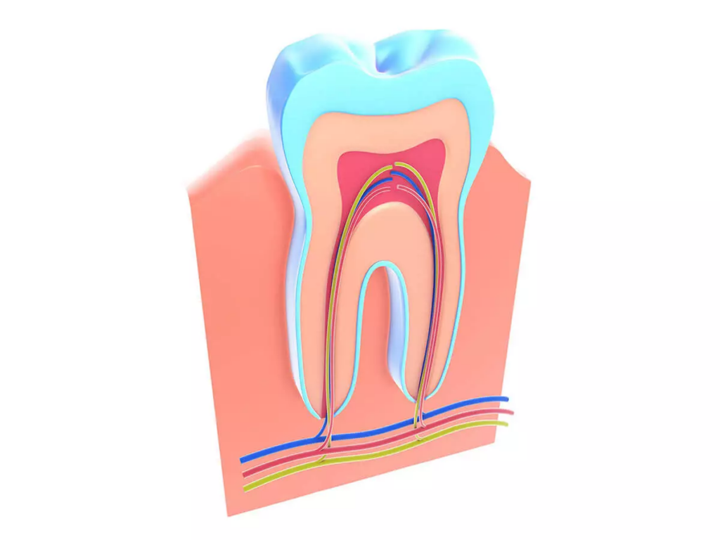 illustration of a tooth's roots exposed that need root canal treatment