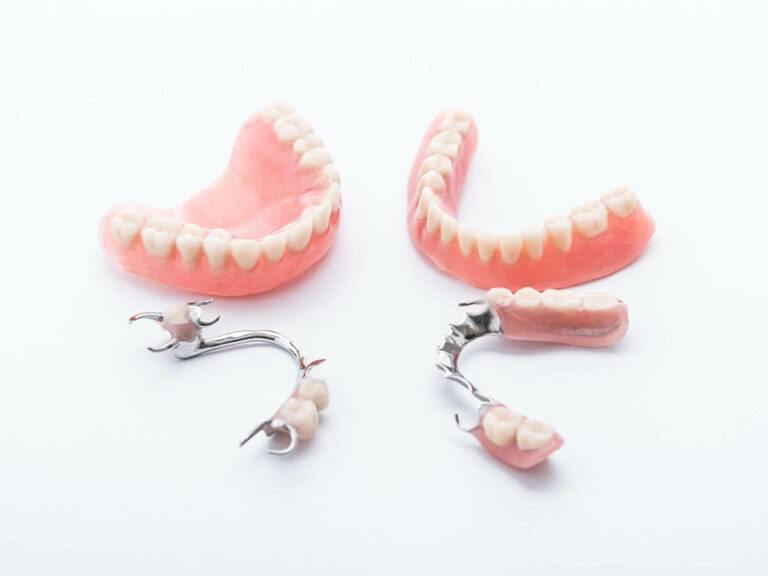 picture of dentures laying next to partial dentures